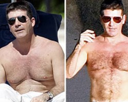 Simon Cowell Loses Man Boobs