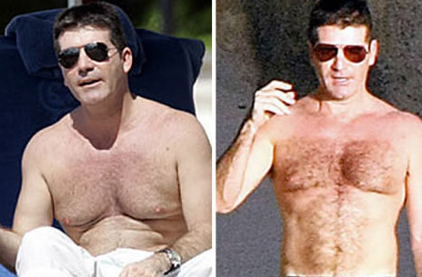 Simon Cowell Loses Man Boobs